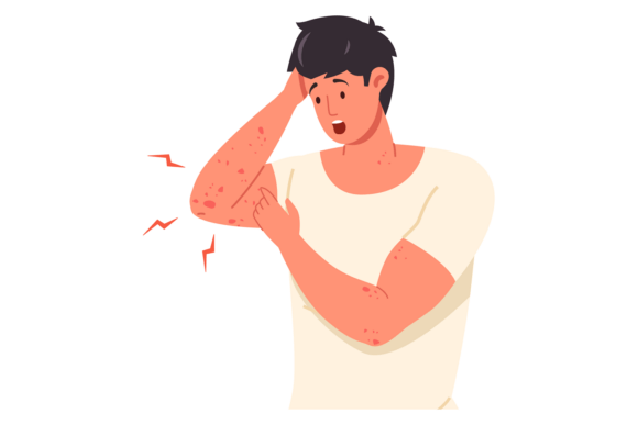 Man Itching Red Rash. Sickness Medical S